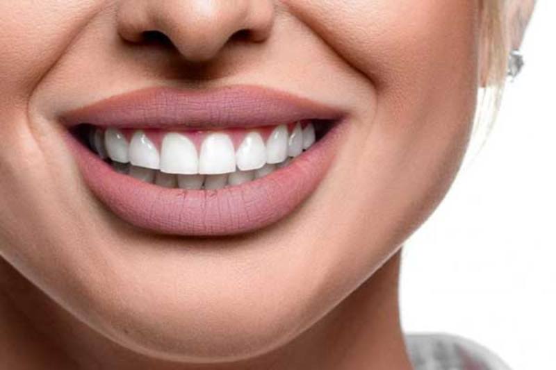 Cosmetic dentist New York | How Do Most Celebrities Fix Their Teeth
