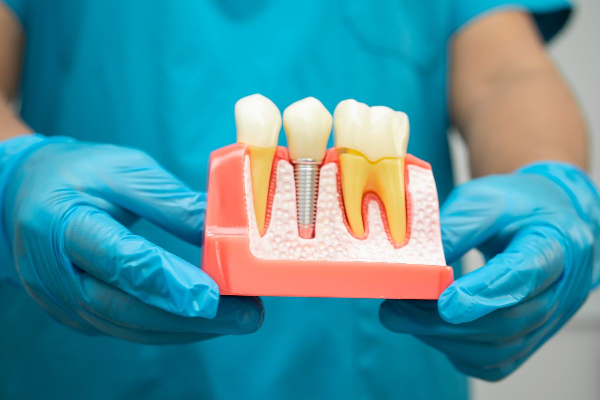 Dental Implants in New York: The Permanent Solution for Missing Teeth