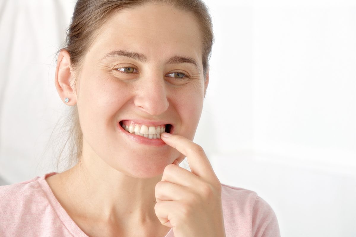 Can Receding Gums Grow Back Naturally?