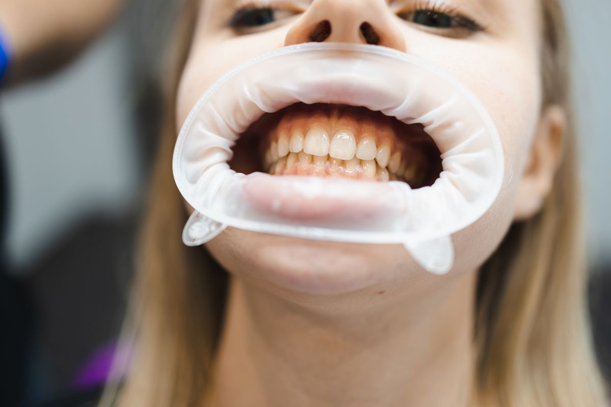 The Hidden Dangers of Untreated Gum Disease