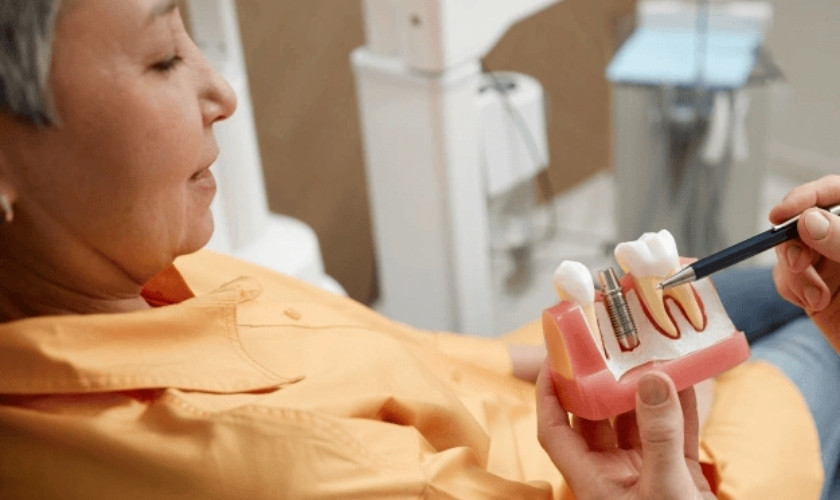 Complete Guide to Replacing Missing Teeth